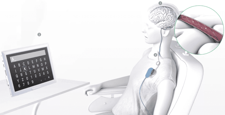 Synchron brain implant