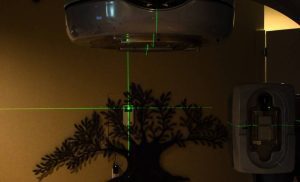 AI reduces cancer radiotherapy treatment time