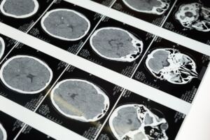 can-hybrid-intelligence-opens-up-new-opportunities-in-healthcare
